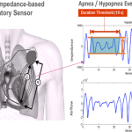 Hypopneas: A Comprehensive Guide hypopneas