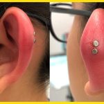 The Challenges of an Infected Ear Piercing Causes, Treatment, and Prevention infected ear piercing