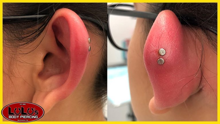 The Challenges Of An Infected Ear Piercing Causes