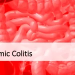Demystifying Ischemic Colitis: Causes, Symptoms, and Management ischemic colitis
