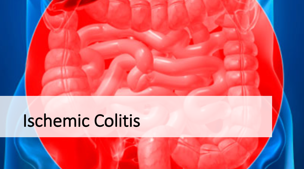 ischemic colitis