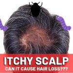 Demystifying Itchy Scalp and Hair Loss Causes, Remedies, and Prevention itchy scalp and hair loss