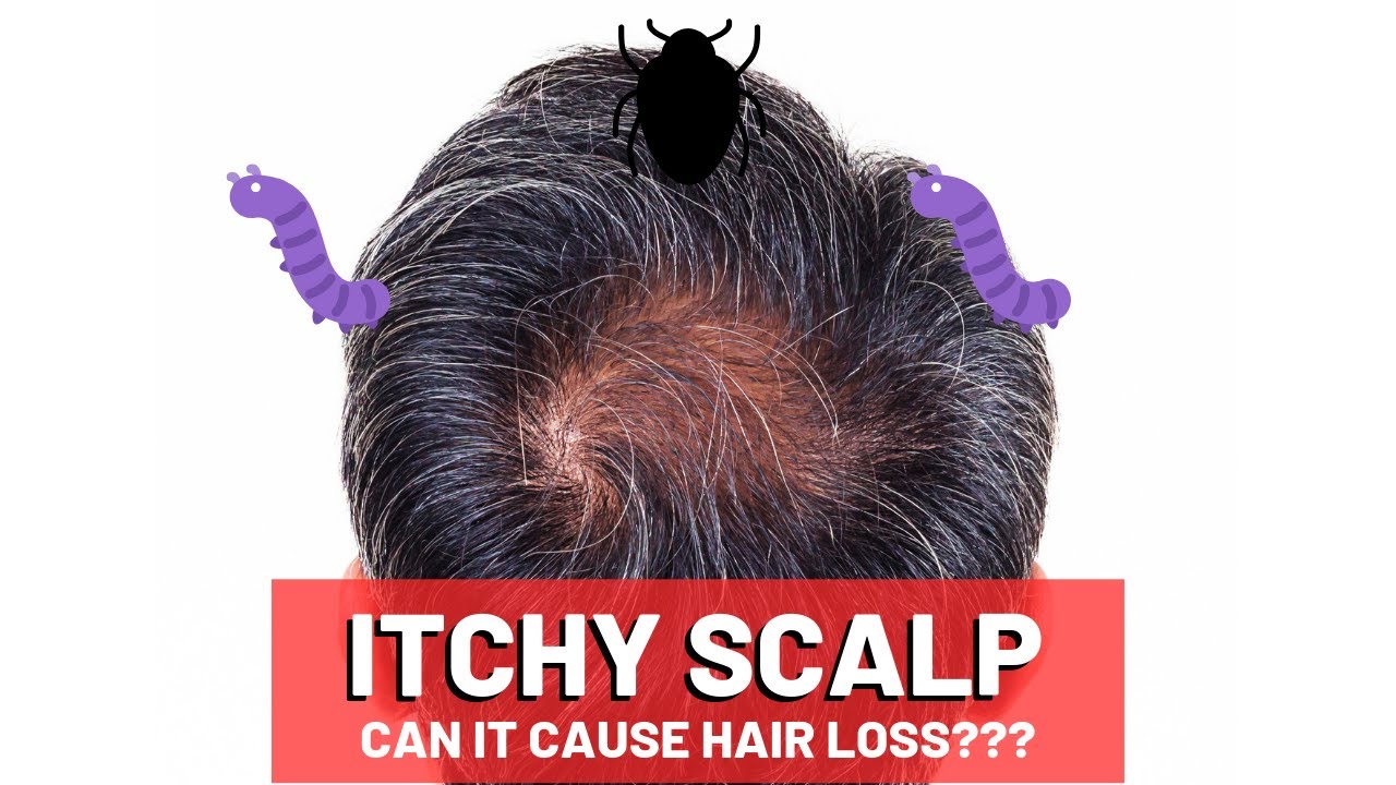 itchy scalp and hair loss