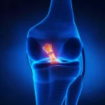 The Mystery of Knee Popping: Causes, Concerns, and Solutions knee popping