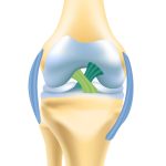 Exploring the Crucial Ligaments of the Knee: Anatomy and Function ligaments of the knee