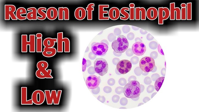 low eosinophils