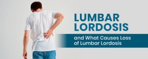 Demystifying Lumbar Lordosis: Causes, Symptoms, And Solutions