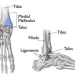 The Ankle Malleolus A Crucial Anatomy Lesson malleolus