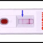 Demystifying the Mono Blood Test What You Need to Know mono blood test