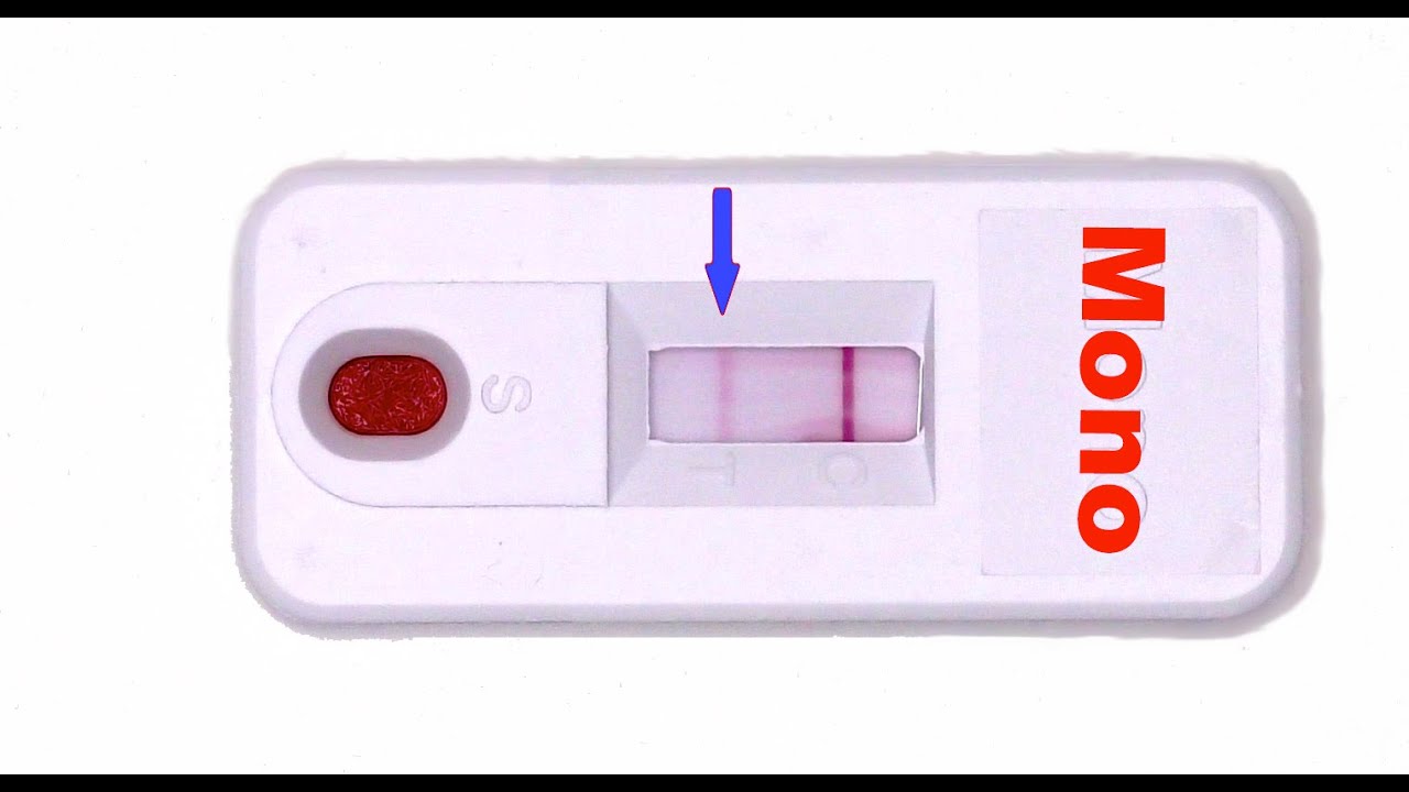 mono blood test