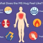 MS Hug Managing this Uncomfortable Symptom ms hug