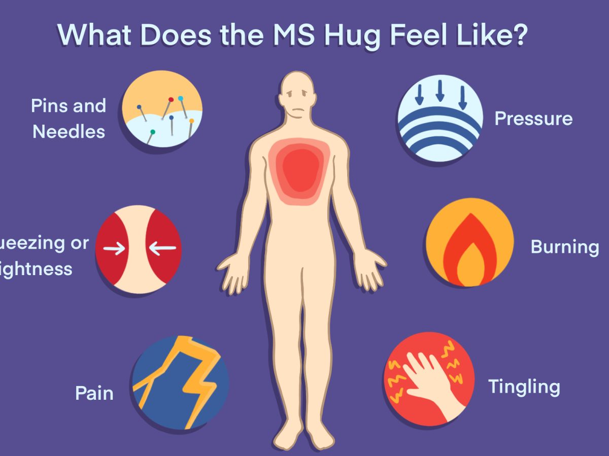 ms hug