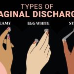 Vaginal Odor When My Discharge Smells Bad but Not Fishy my discharge smells bad but not fishy