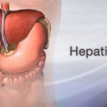 Hepatitis B Transmission: Can I Contract It If My Husband Has It? my husband has hepatitis b can i get it