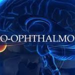 The Mysteries of Vision: The Role of a Neuro Ophthalmologist neuro ophthalmologist