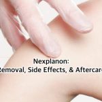 Nexplanon Removal: What You Need to Know nexplanon removal