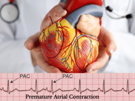 pac ecg