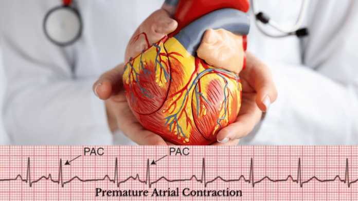 PAC ECG: The Science Behind Premature Atrial Contractions