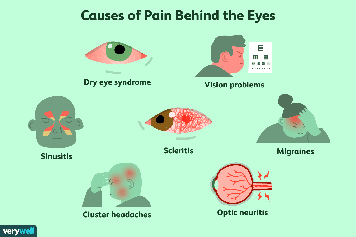 pain behind eye
