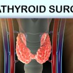 The Benefits and Risks of Parathyroidectomy parathyroidectomy