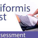 The Definitive Piriformis Syndrome Test Guide piriformis syndrome test