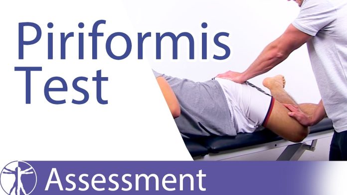 The Definitive Piriformis Syndrome Test Guide