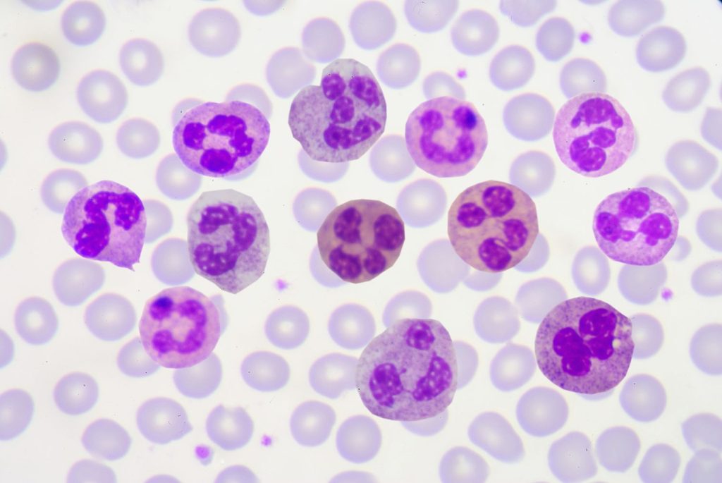 rare polymorphonuclear leukocytes