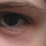 Dealing with a Rash Around Eyes: Causes and Remedies rash around eyes