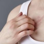 The Mystery: Treating Rash on Breast rash on breast