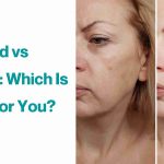 The Beauty Secret Retinol vs. Retinoid Showdown retinol vs retinoid