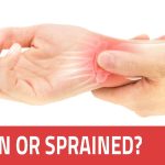 Treating a Sprained Wrist Causes, Symptoms, and Recovery sprained wrist