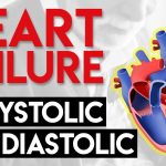 Systolic Heart Failure Causes, Symptoms, and Management systolic heart failure