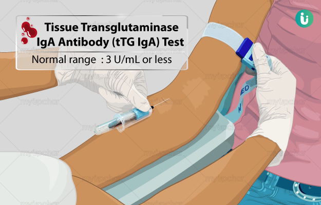 Demystifying Tissue Transglutaminase IgA: Understanding Its Role ...