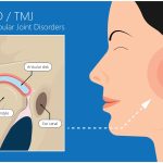 Finding Relief Your Local TMJ Specialist Near Me tmj specialist near me