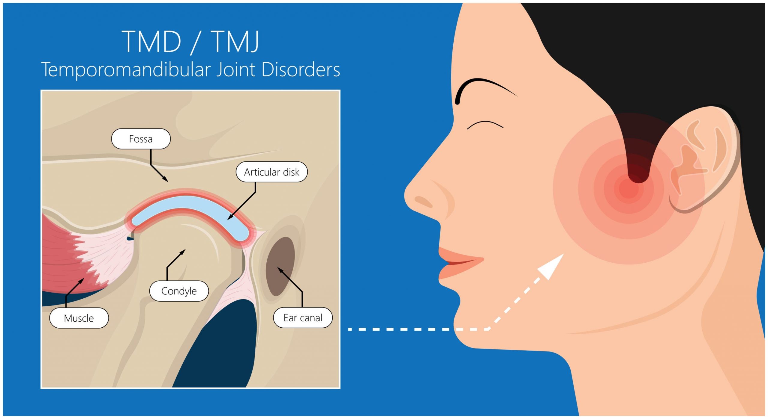 tmj specialist near me