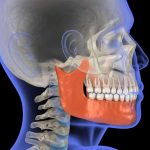 The Ultimate Guide to TMJ Surgery: What You Need to Know tmj surgery