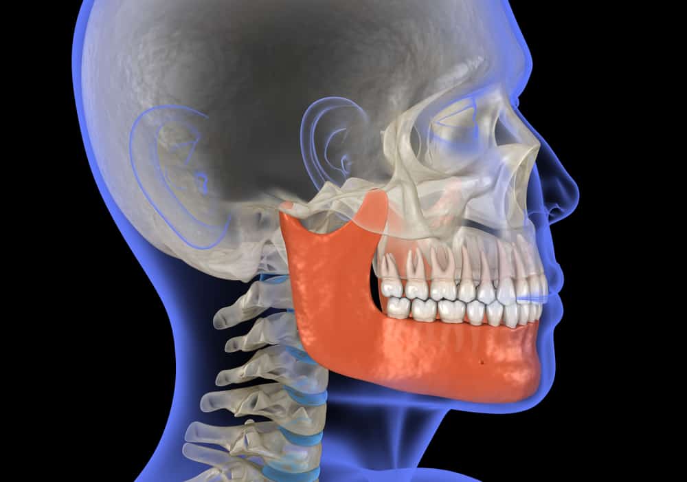 tmj surgery