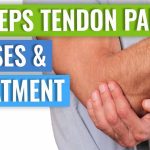 Tricep Tendonitis: Causes, Symptoms, and Recovery Strategies tricep tendonitis