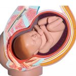 Uterine Atony: Causes, Symptoms, and Lifesaving Solutions uterine atony