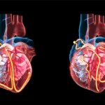 Decoding Cardiac Arrhythmias: V Fib vs. V Tach Explained v fib vs v tach