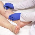 The Vascular Doctor’s Guide: Your Path to Heart and Circulatory Wellness vascular doctor