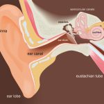 Dealing with Water Stuck in Ear for Days Causes and Solutions water stuck in ear for days
