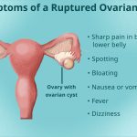 Ovarian Cyst Pain What Does It Really Feel Like? what does ovarian cyst pain feel like