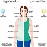 Thyroid Health What is Considered a Dangerously High TSH Level? what is considered a dangerously high tsh level