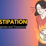 Where is Constipation Pain Felt? A Guide to Discomfort where is constipation pain felt