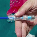 Zoladex its Benefits, Side Effects, and Uses zoladex