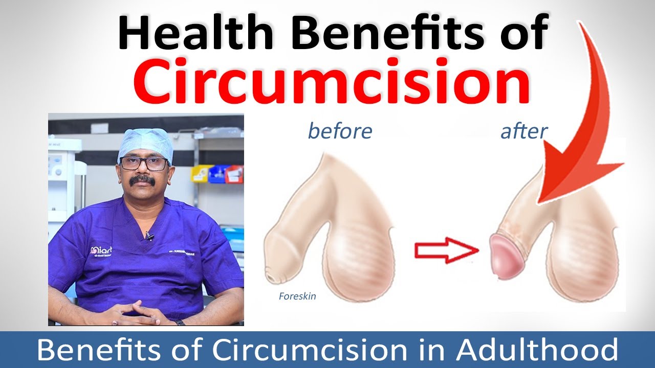 benefit of circumcision