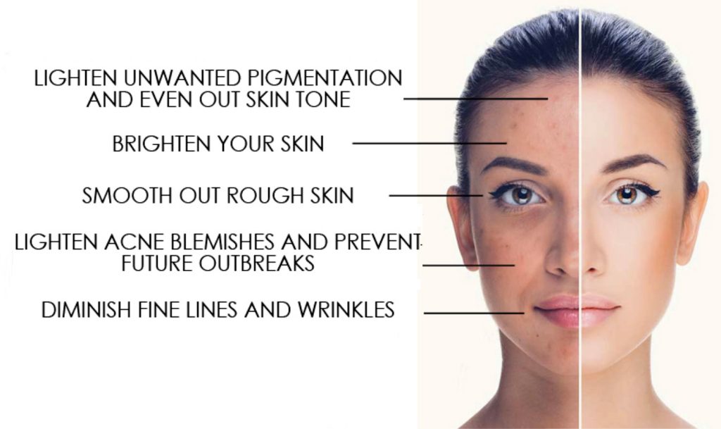 Reveal Glowing Skin, Incredible Benefits of a Chemical Peel