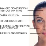 Reveal Glowing Skin, Incredible Benefits of a Chemical Peel benefits of a chemical peel