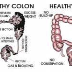 The Incredible Benefits of a Colon Cleanse for a Healthier You benefits of a colon cleanse